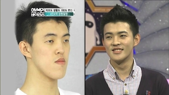 Foto: kpsurgery.tumblr.com