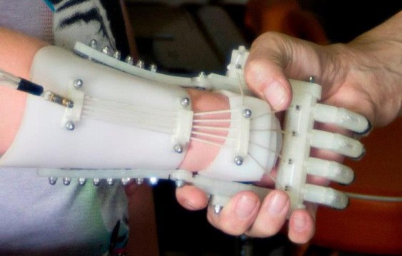 Fotografía: Facebook (Robohand)