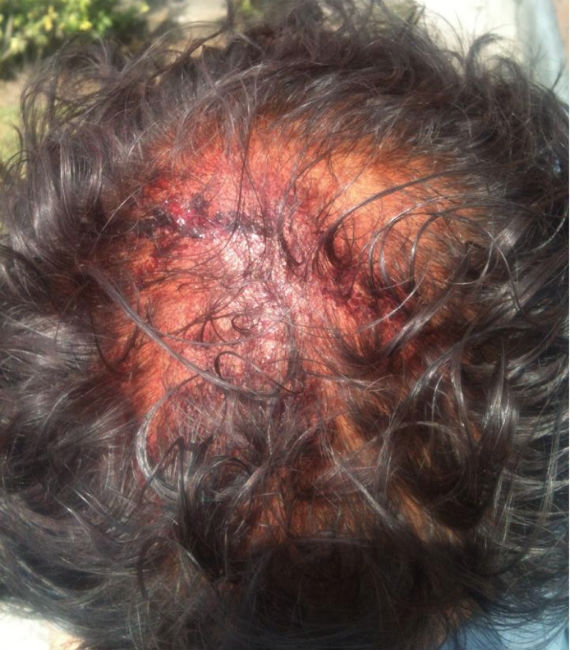 El periodista presentó golpes en la cabeza. Foto: Facebook DSM Puebla