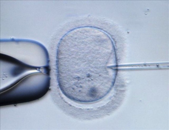 La técnica de triple procedencia genética puede dar una solución a las enfermedades mitocondriales. Foto: EFE