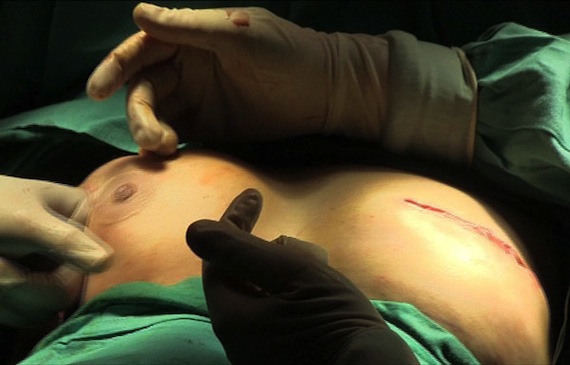 Enfermedades como el cáncer de mama podrían diagnosticarse a tiempo gracias a detectores olfativos. Foto: EFE