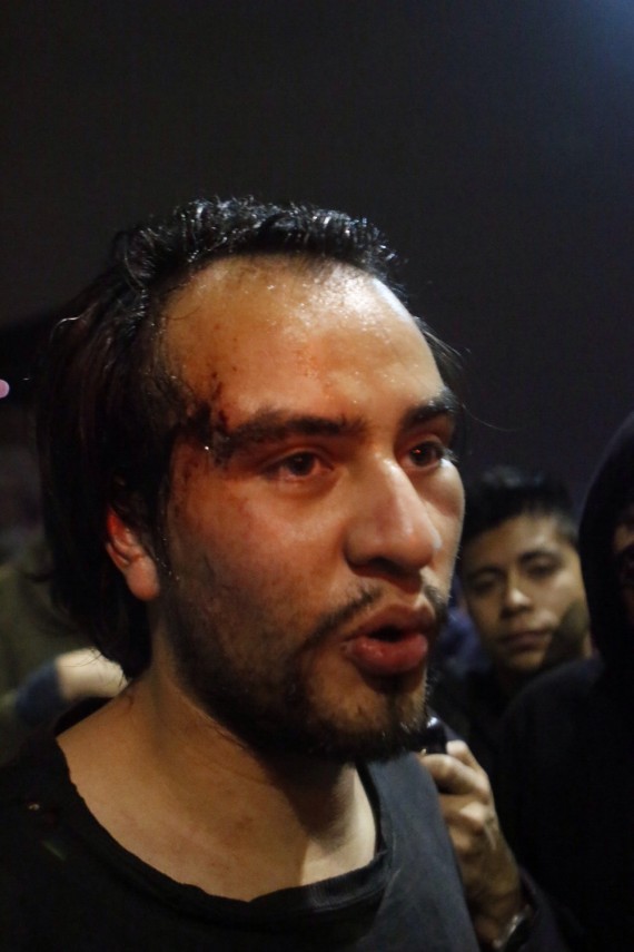 Herido por los granaderos. Foto: Francisco Cañedo, SinEmbargo