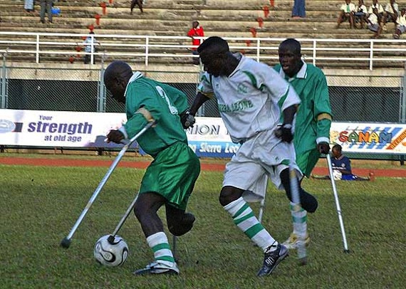 El síndrome del miembro fantasma no tiene su raíz en el cerebro como se solía creer. Foto: EFE