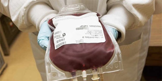 Los experimentos realizados en ratones mostraron los efectos benéficos de la sangre joven. Foto: EFE