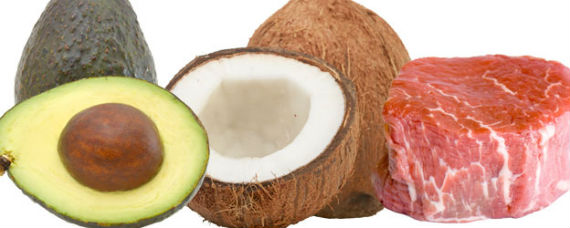 Los alimentos saludables según esta visión. Foto: www.drperlmutter.com