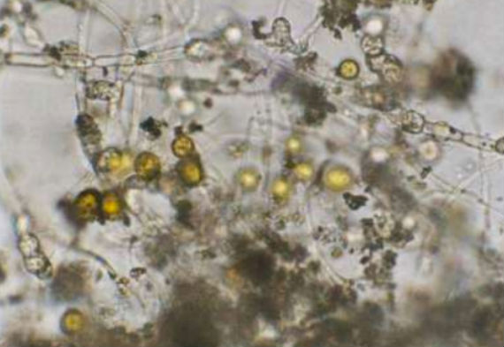 Las algas han podido crecer en tierra extraída de meteoritos, por lo que la idea del doctor Mautner no es descabellada. Foto: Geek