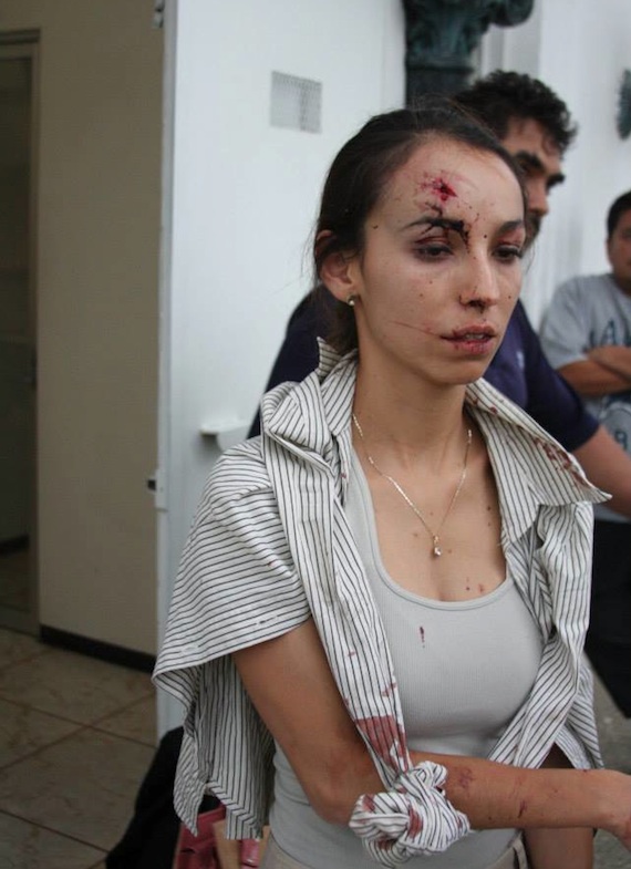 Karla Silva fue atacada por un hombre, quien acudió a buscarla en compañía de otros dos sujetos a la redacción del diario. Foto:  Facebook Miguel Ramirez