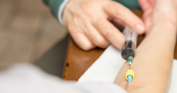 Las terapias de hidratación IV tienen un costo mayor a los 119 dólares. Foto: Shutterstock