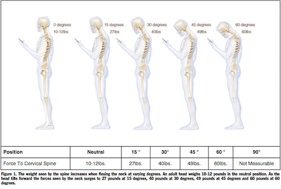 Imagen: New York Spine Surgery & Rehabilitation Medicine