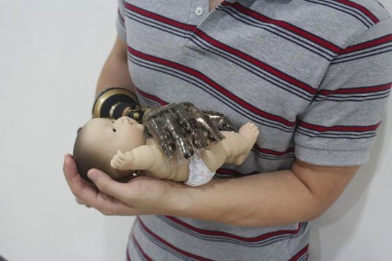 La piel artificial no sólo siente el calor externo sino que transmite la misma temperatura que el cuerpo humano. foto: