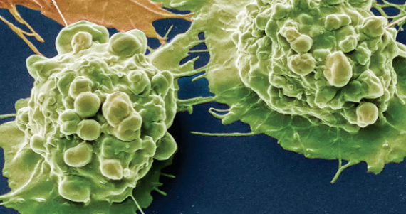El estudio muestra que el número de divisiones de células madre en un tipo de tejido esta "altamente correlacionado" con la incidencia de cáncer en ese mismo tejido. Foto: www.sciencemag.org