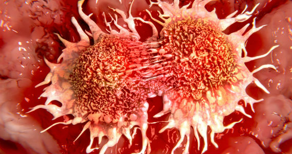 Imagen: Shutterstock