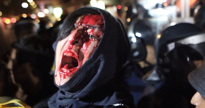 Uno de los jóvenes golpeados. Foto: Francisco Cañedo, SinEmbargo