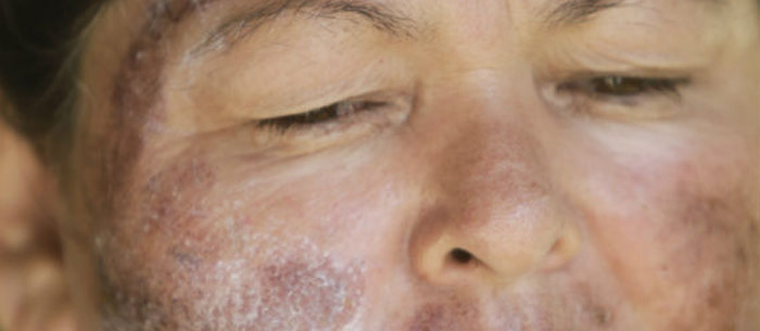 Luz Mercedes Acosta, habitante de la zona afectada por el derrame de la mina de Grupo México, asegura que fue afectada al lavarse la cara con agua del Río Sonora sin saber que estaba contaminada con ácidos y metales pesados. Foto: Cuartoscuro