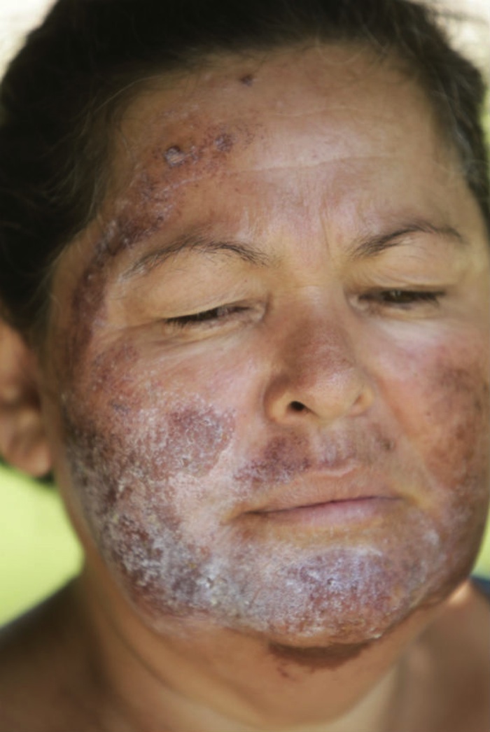 Luz Mercedes Acosta, habitante de la zona, quien fue afectada al lavarse la cara con agua del río Sonora sin saber que estaba contaminada con ácidos y metales pesados. Foto: Cuartoscuro