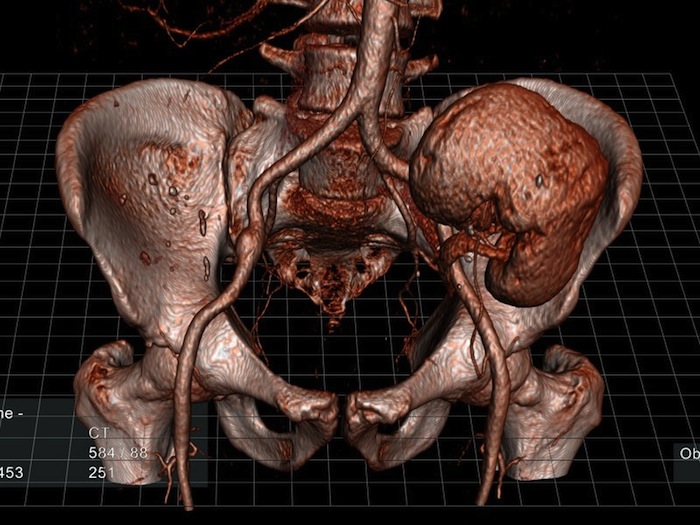 Las imágenes tridimensionales actuales siguen presentándose en dos dimensiones. Con una proyección holográfica esto cambiaría. Foto: EchoPixel