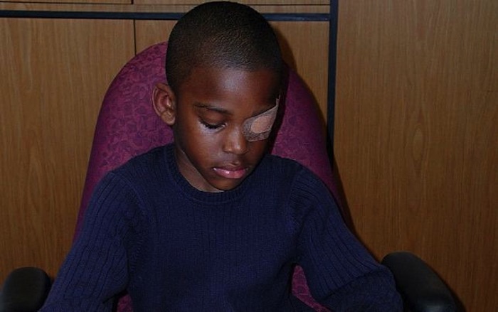 El tratamiento más usual para ambliopía consiste en cubrir el ojo sano del paciente. sin embargo lleva mucho tiempo. Foto: Wikimedia Commons