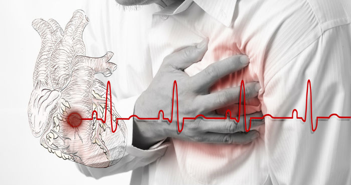 Resultado de imagen para ¿Que factores pueden provocar un ataque al corazón?