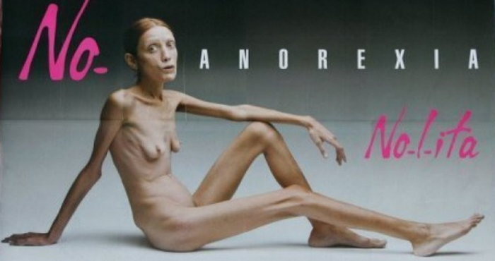 En la imagen se observa a la francesa Isabelle Caro, modelo que se hizo famosa en 2007 después de ser fotografiada desnuda por Oliviero Toscani para una controvertida campaña publicitaria llamada "No anorexia". Murió en noviembre de 2010. Foto: Especial