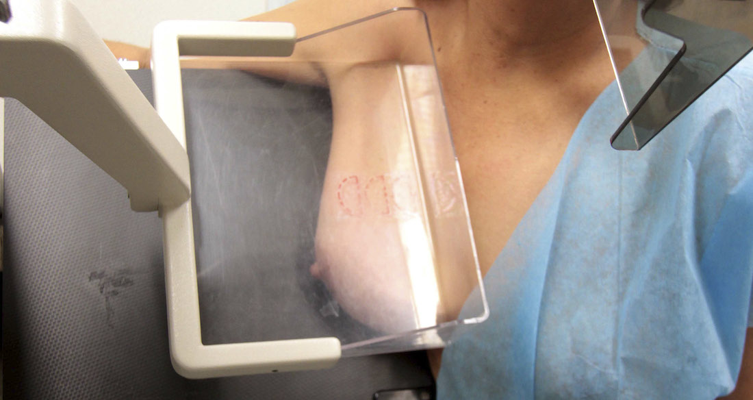 México desarrolla nanobiosensor para detectar cáncer de mama con saliva. Foto: Cuartoscuro