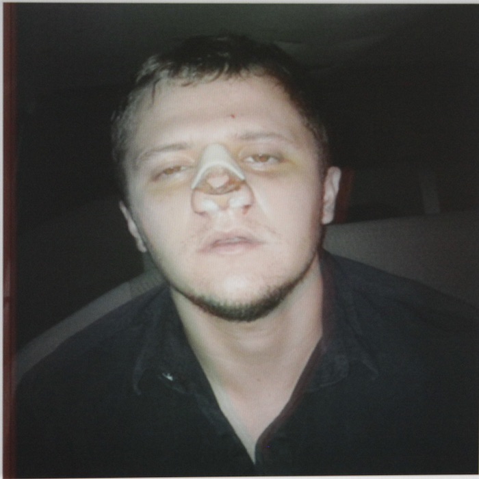 Existen indicios de que “El Menchito” se operó la nariz recientemente. Foto: Cuartoscuro