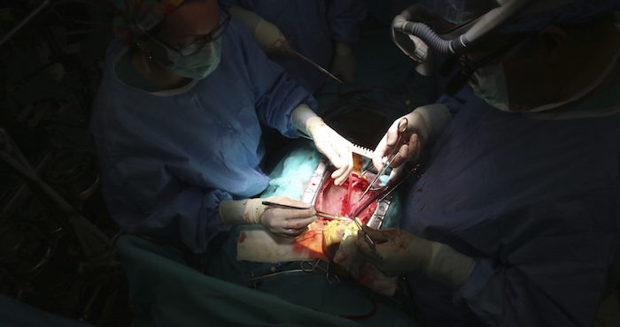 Cirujanos chinos han trasplantado a una niña de tres años con hidrocefalia un cráneo de titanio obtenido mediante la técnica de impresión tridimensional (3D). Foto: EFE