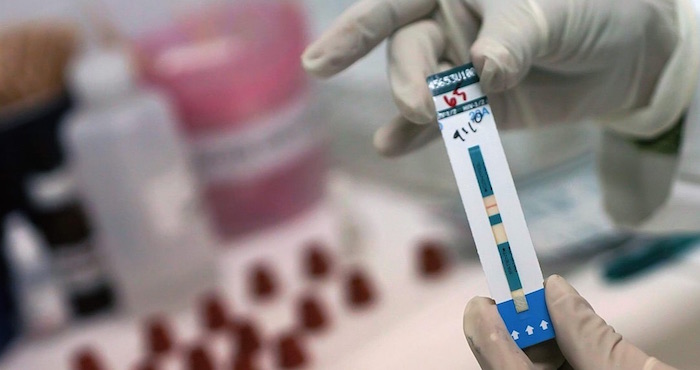 La joven, que tiene 18 años, dejó de tomar medicamentos antiretrovirales cuando tenía seis. Foto: EFE