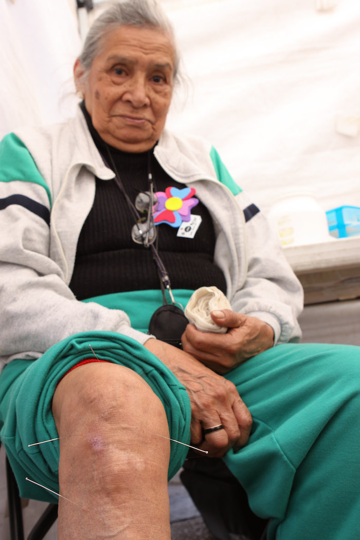 Una mujer se trata un dolor crónico en la rodilla durante una feria de salud en la Delegación Miguel Hidalgo. Foto: Cuartoscuro