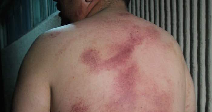 Más de 4 mil casos de tortura han sido denunciados ante la PGR en ocho años, denunciaron expertos. Foto: Vaguardia