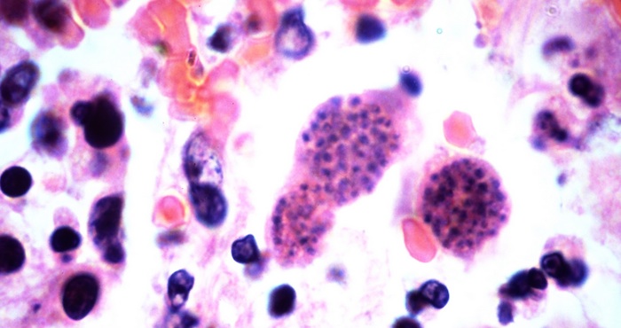 Toxoplasmosis. Foto: Wikimmedia Commons.