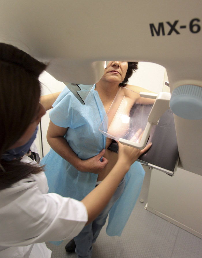 Prueba de mastografía Ciertos cánceres de mama están relacionados con el rol que juegan las hormonas femeninas. Foto: Cuartoscuro