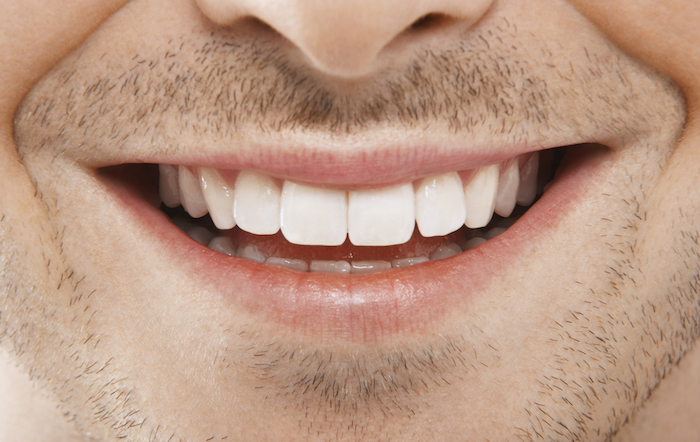 Sonrisa Sonrisa muestra dientes sanos