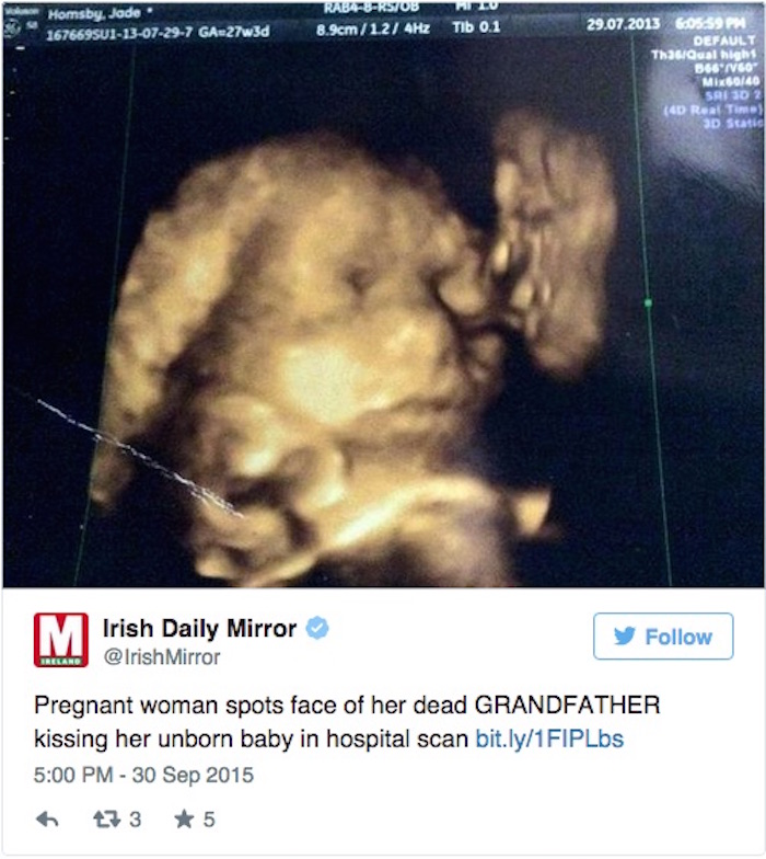 Foto: Twitter vía @IrishMirror