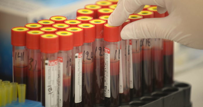 La muerte por Sida en jóvenes se ha triplicado. Foto:EFE