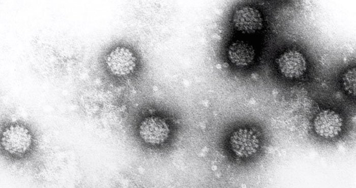 Virus del papiloma humano. Foto: EFE