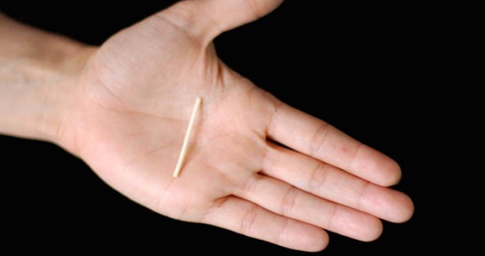 implante anticonceptivo. Foto: EFE