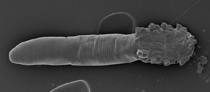 Más ácaros del rostro. Foto: Licencia pública