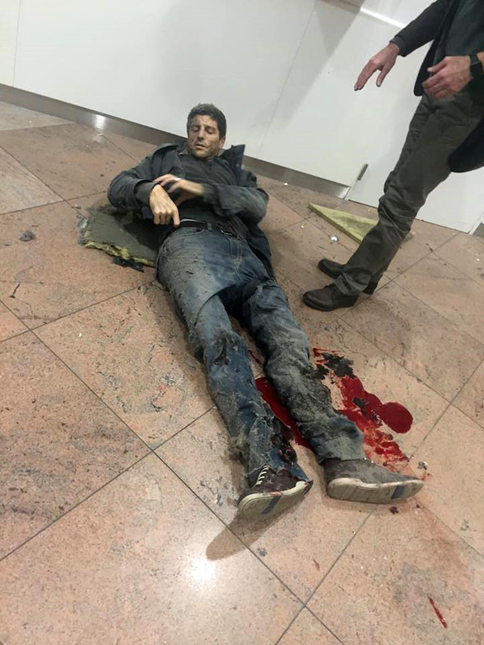 En esta imagen proporcionada por la televisora pública de Georgia y tomada por Ketevan Kardava, un hombre herido en el aeropuerto de Brusela. Foto: AP.
