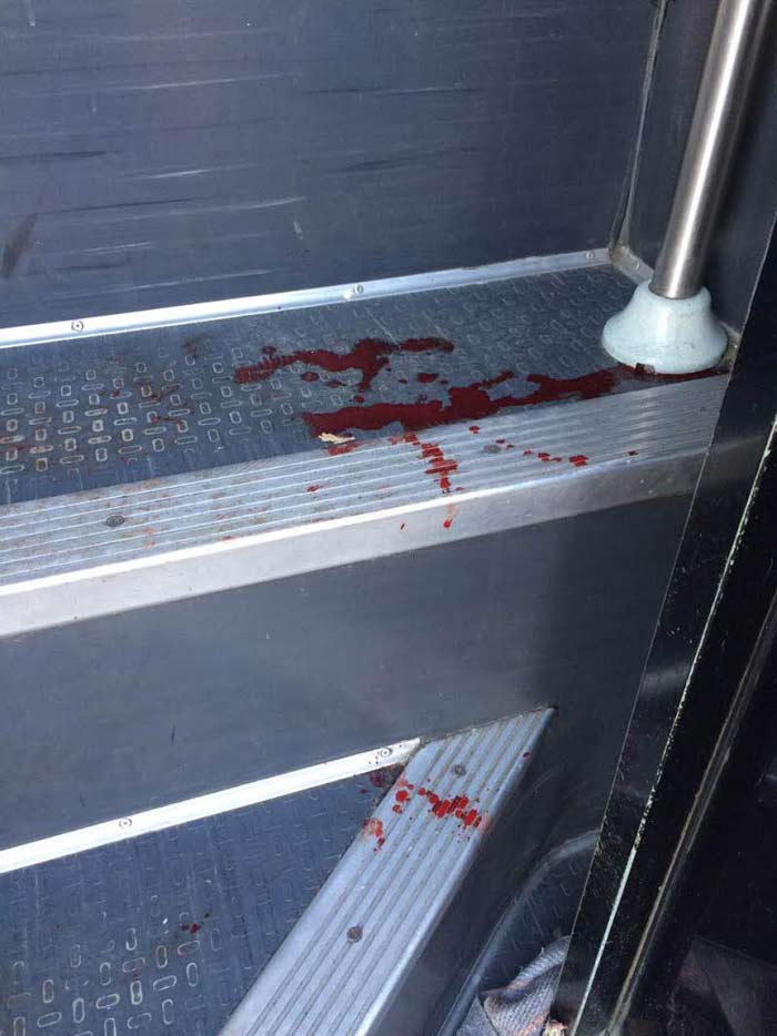 La mujer embarazada va herida en un pie. Foto: Especial