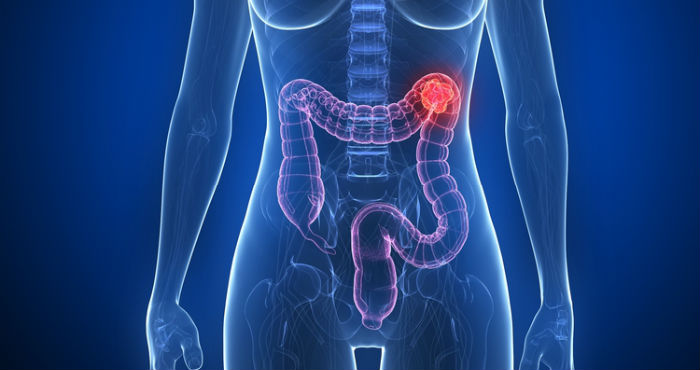 Imagen: Shutterstock