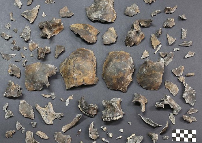 Fragmentos del hueso craneal. Foto: LaOpinión