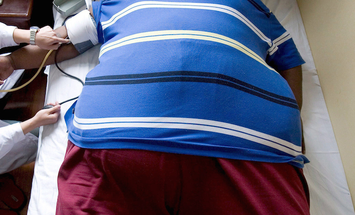 El estudio nuevo encontró además que estar obeso es mucho más peligroso para los hombres que para las mujeres. Foto EFE