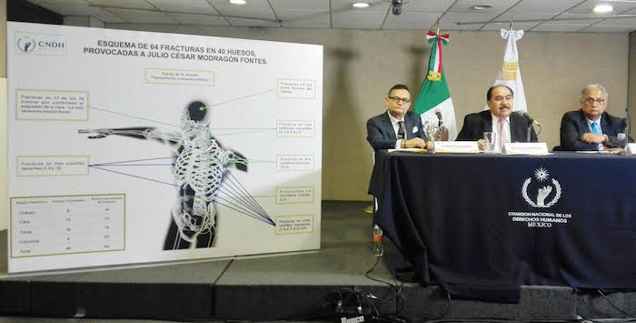 Antes de morir, a Julio le provocaron fracturas en ocho huesos del cráneo y en 13 de la cara y en el tórax. En total, su cuerpo presentó 64 fracturas. Foto: Luis Barrón, SinEmbargo.