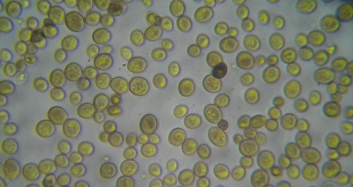 Virus visto en microoscopio. Foto: Especial