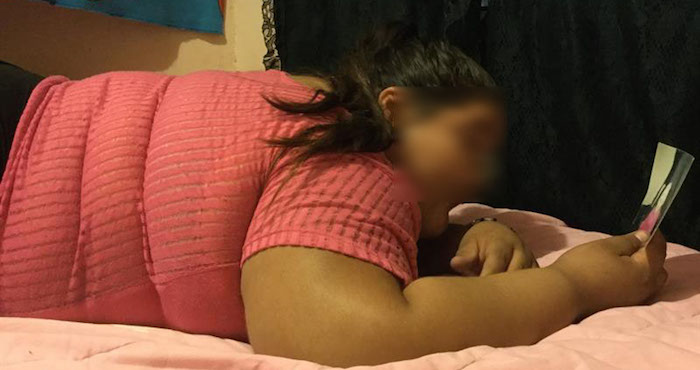 "Estoy muy contenta por esta operación, ya no quiero estar así, quiero que mi vida cambie y la gente no se me quede viendo", dijo a Efe Dayana desde su natal Colorado, un poblado chiquito ubicado en las afueras de Guasave, en el noroccidental estado de Sinaloa. Foto: La Opinion