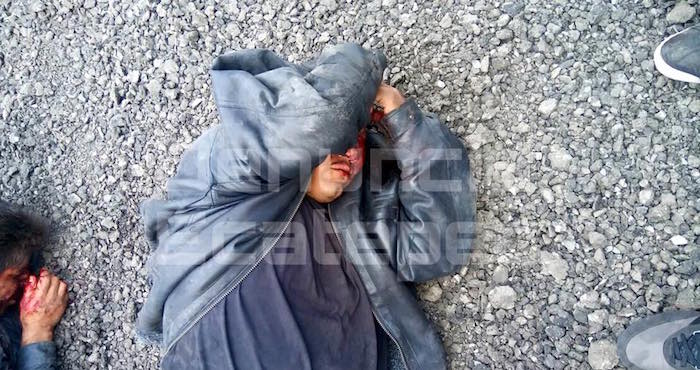 Los dos hombres fueron severamente golpeados en la cara. Foto: Facebook, Denuncia Ecatepec