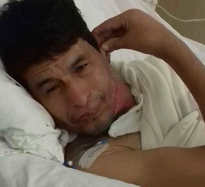 50 días de dolor fue el tiempo que Rigo duró hospitalizado con las heridas abiertas. No soportó y murió. Foto: VANGUARDIA