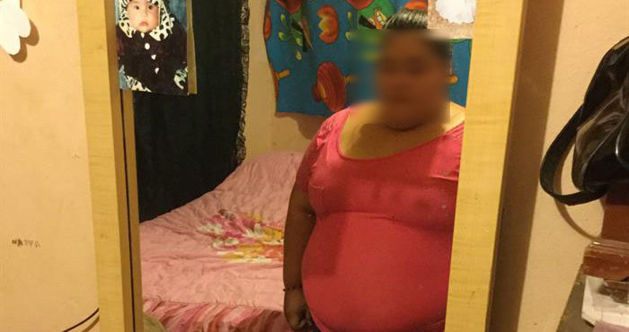 Dayana es un caso de obesidad extrema, tiene un Índice de Masa Corporal (IMC) superior a 70 cuando lo aconsejable es entre 18 y 25. Foto: La Opinion