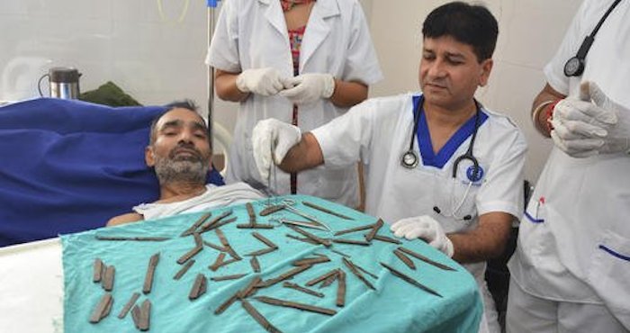 Los médicos aseguraron que nunca habían visto un caso similar. Foto: AP/ Prabhjot Gill