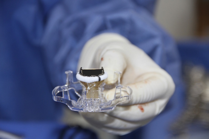 La válvula metálica que sustituirá a la original. Foto: LaOpinión